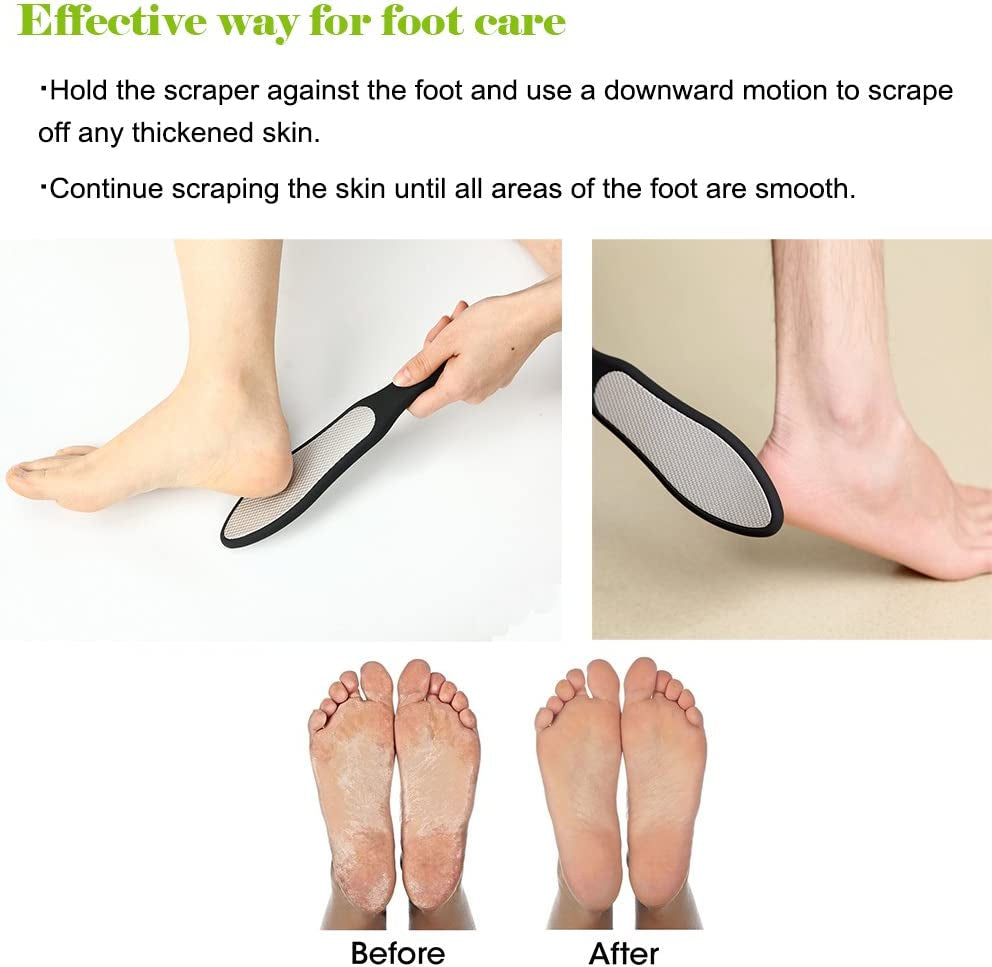 Premium Double-Sided Foot File – Heavy Duty Stainless Steel Pedicure Rasp for Cracked Heels & Callus Removal, Soft Silicone Handle