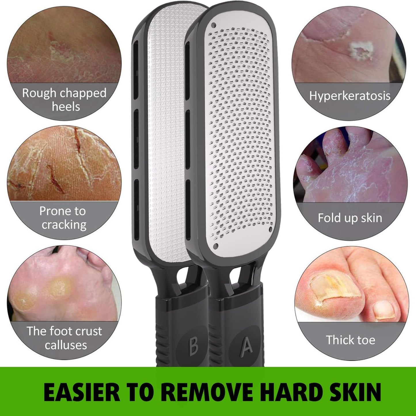 2-in-1 Foot File Scraper – Double-Sided Metal Callus Remover Pedicure Tool for Hard Skin, 1-Pack
